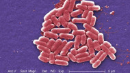 U.S. sees first case of bacteria resistant to last-resort antibiotic