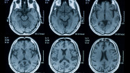 Neuroscientist Shows What Fasting Does To Your Brain