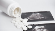 اغلاق الشريان الرحمي مع دواء الميثوتركسيت يفيد في علاج الحمل خارج الرحم
