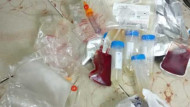 ضبط 26 قربة دم وأدوية منتهية الصلاحية بـ 3 مستشفيات بالشرقية