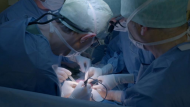نجاح أول جراحة في لبنان لاستئصال تشوه كبير من عين طفل